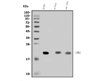 SCG10/STMN2 Rabbit Polyclonal Antibody