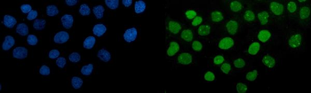 PARP/PARP1 Mouse Monoclonal Antibody