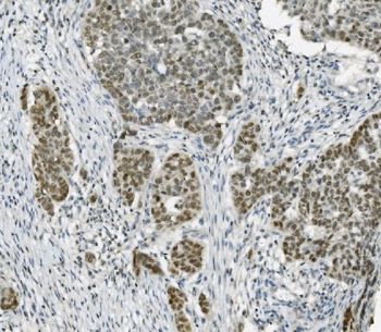 PARP/PARP1 Mouse Monoclonal Antibody