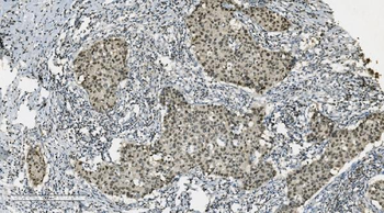 PARP/PARP1 Mouse Monoclonal Antibody