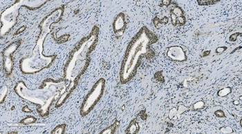 PARP/PARP1 Mouse Monoclonal Antibody