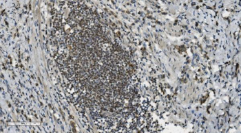 PARP/PARP1 Mouse Monoclonal Antibody