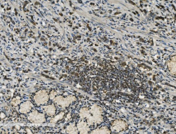 PARP/PARP1 Mouse Monoclonal Antibody
