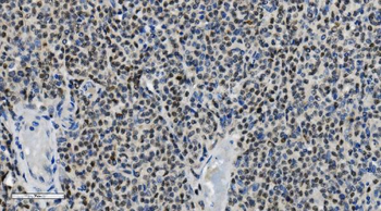 PARP/PARP1 Mouse Monoclonal Antibody