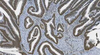 PARP/PARP1 Mouse Monoclonal Antibody