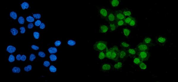 PARP/PARP1 Mouse Monoclonal Antibody