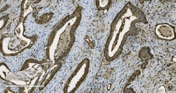 PARP/PARP1 Mouse Monoclonal Antibody