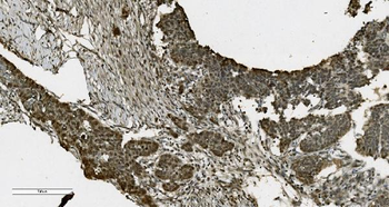 PARP/PARP1 Mouse Monoclonal Antibody