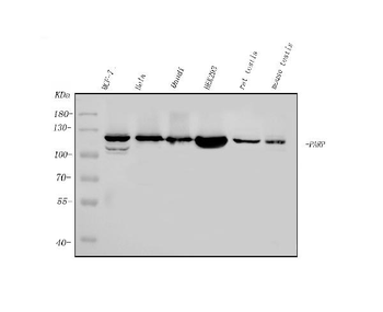 PARP/PARP1 Mouse Monoclonal Antibody