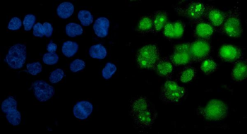 PARP/PARP1 Mouse Monoclonal Antibody