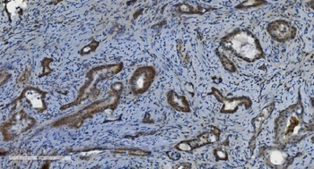 PARP/PARP1 Mouse Monoclonal Antibody
