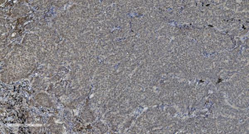 PARP/PARP1 Mouse Monoclonal Antibody