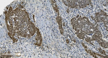 PARP/PARP1 Mouse Monoclonal Antibody