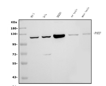 PARP/PARP1 Mouse Monoclonal Antibody