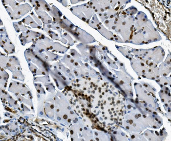 Transketolase/TKT Mouse Monoclonal Antibody