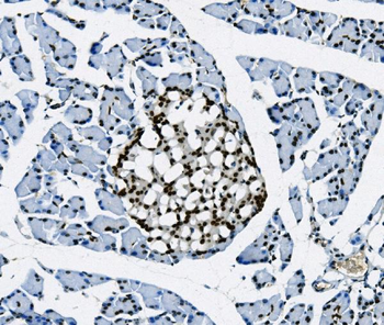 Transketolase/TKT Mouse Monoclonal Antibody