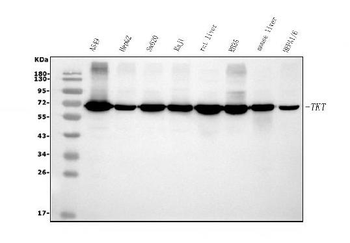 Transketolase/TKT Mouse Monoclonal Antibody