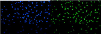 Transketolase/TKT Mouse Monoclonal Antibody