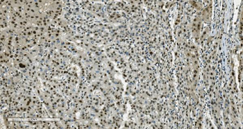 Transketolase/TKT Mouse Monoclonal Antibody