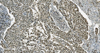 Transketolase/TKT Mouse Monoclonal Antibody