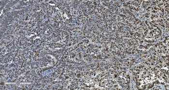 Transketolase/TKT Mouse Monoclonal Antibody