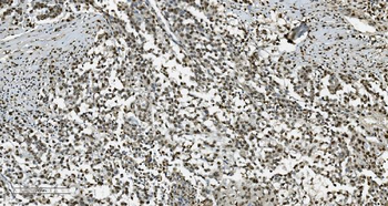 Transketolase/TKT Mouse Monoclonal Antibody
