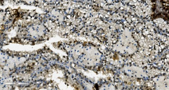 Transketolase/TKT Mouse Monoclonal Antibody