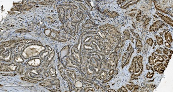 Transketolase/TKT Mouse Monoclonal Antibody