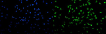 Transketolase/TKT Mouse Monoclonal Antibody