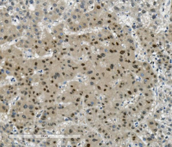 Transketolase/TKT Mouse Monoclonal Antibody