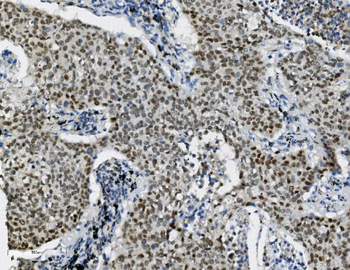 Transketolase/TKT Mouse Monoclonal Antibody