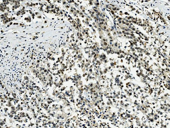 Transketolase/TKT Mouse Monoclonal Antibody