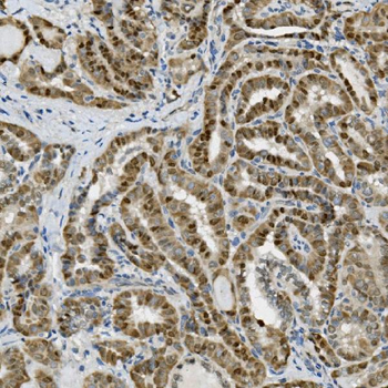 Transketolase/TKT Mouse Monoclonal Antibody