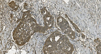 U2AF65/U2AF2 Mouse Monoclonal Antibody