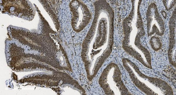 U2AF65/U2AF2 Mouse Monoclonal Antibody