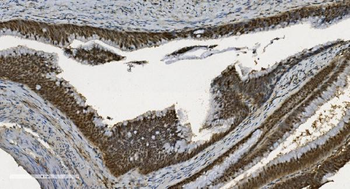 U2AF65/U2AF2 Mouse Monoclonal Antibody