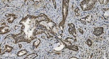 U2AF65/U2AF2 Mouse Monoclonal Antibody
