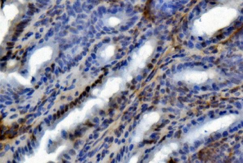 U2AF65/U2AF2 Mouse Monoclonal Antibody