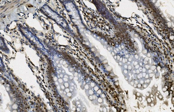 U2AF65/U2AF2 Mouse Monoclonal Antibody