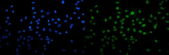 U2AF65/U2AF2 Mouse Monoclonal Antibody