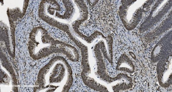U2AF65/U2AF2 Mouse Monoclonal Antibody