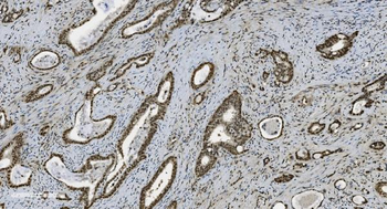 U2AF65/U2AF2 Mouse Monoclonal Antibody