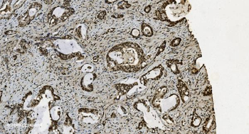 U2AF65/U2AF2 Mouse Monoclonal Antibody