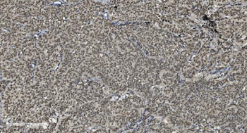U2AF65/U2AF2 Mouse Monoclonal Antibody