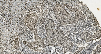 U2AF65/U2AF2 Mouse Monoclonal Antibody