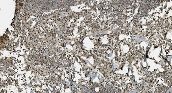 U2AF65/U2AF2 Mouse Monoclonal Antibody