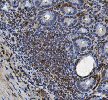 U2AF65/U2AF2 Mouse Monoclonal Antibody