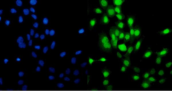 MCM5 Mouse Monoclonal Antibody