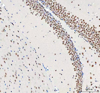 DDX1 Mouse Monoclonal Antibody