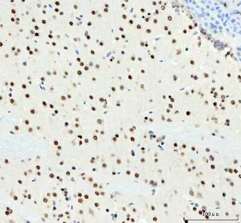 DDX1 Mouse Monoclonal Antibody